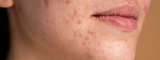 Научная деятельность врачей Северо-Западного центра доказательной медицины