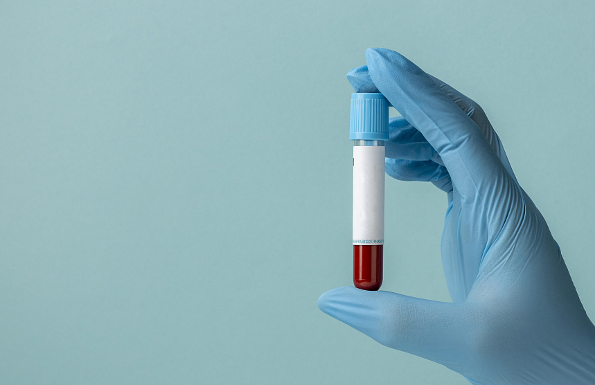 Скидка 20% на лабораторные исследования